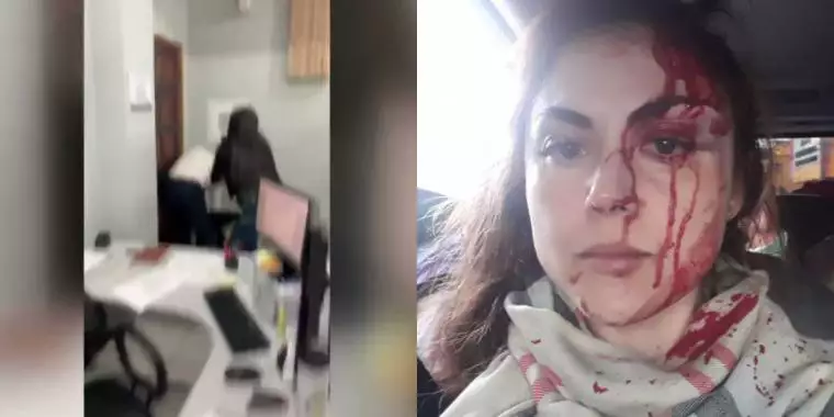 Homem que agrediu procuradora de São Paulo vira réu por tentativa de feminicídio